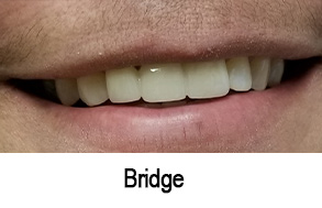 Smile Gallery - After