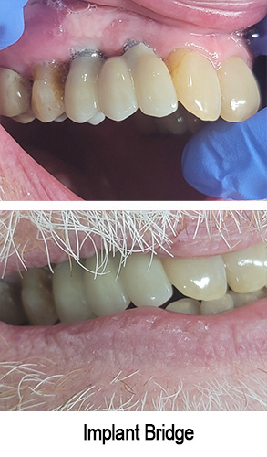 Smile Gallery - After