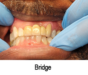 Smile Gallery - Before