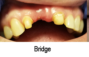 Smile Gallery - Before