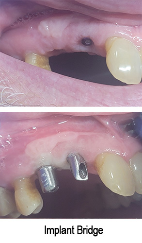 Smile Gallery - Before