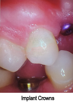 Smile Gallery - Before